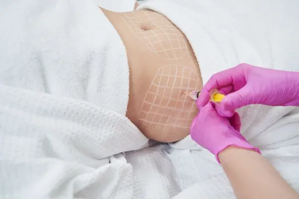 image of fat dissolving injections on love handles to help combat weight gain Birmingham