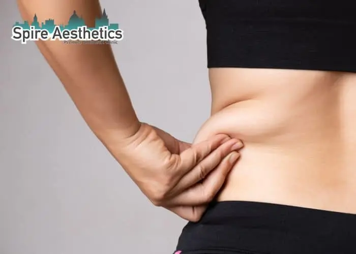 Image of woman pinching fat on their hips Birmingham. Fat Freezing treatment 